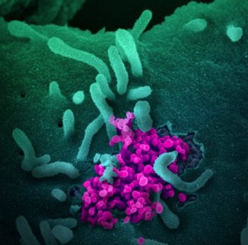 This image shows a collection of particles (colored pink) of the new coronavirus, SARS-CoV-2, emerging from an infected cell in a scanning-electron-microscope image.